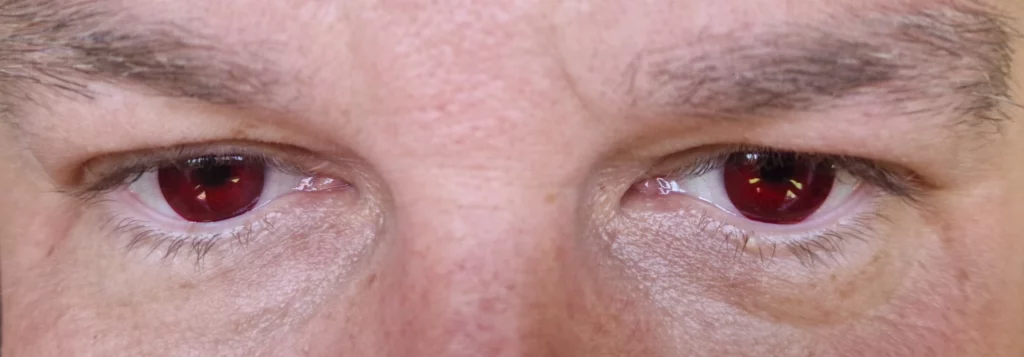 soczewki dla daltonistów na oczach