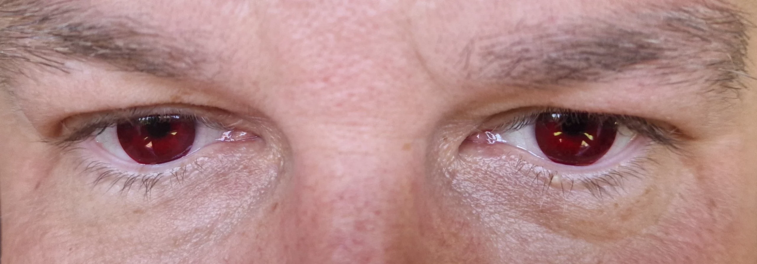 soczewki dla daltonistów na oczach